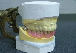 Prothésiste dentaire